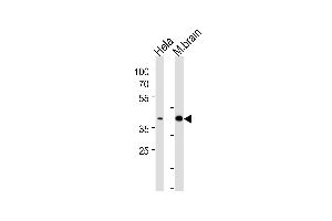 ATF2 Antibody (p) (ABIN1538301 and ABIN2848542) western blot analysis in Hela cell line and mouse brain tissue lysates (35 μg/lane). (ATF2 anticorps  (AA 318-347))