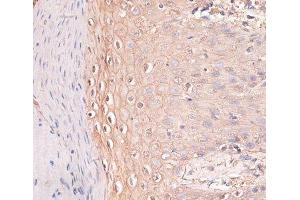 Immunohistochemistry of paraffin-embedded Human skin using CDH3 Polyclonal Antibody at dilution of 1:100 (40x lens). (P-Cadherin anticorps)