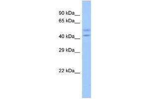 Host:  Rabbit  Target Name:  ZNF679  Sample Type:  Fetal Heart lysates  Antibody Dilution:  1. (ZNF679 anticorps  (N-Term))