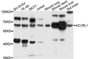 Western blot analysis of extracts of various cell lines, using ACVRL1 antibody (ABIN5996082) at 1/1000 dilution. (ACVRL1 anticorps)