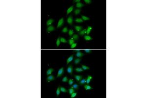 Immunofluorescence analysis of HeLa cell using PPP2CA antibody. (PPP2CA anticorps)