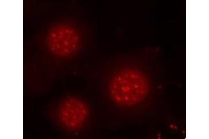 Immunofluorescence analysis of methanol-fixed MCF-7 cells using Phospho-FOXO4-S197 antibody (ABIN3019724, ABIN3019725, ABIN3019726 and ABIN1681609). (FOXO4 anticorps  (pSer197))