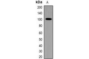 Western blot analysis of TRPV4 expression in HepG2 (A) whole cell lysates. (TRPV4 anticorps)