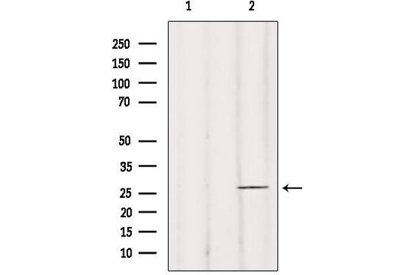 BRMS1 anticorps  (N-Term)