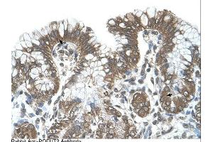 POFUT2 antibody was used for immunohistochemistry at a concentration of 4-8 ug/ml. (POFUT2 anticorps  (C-Term))