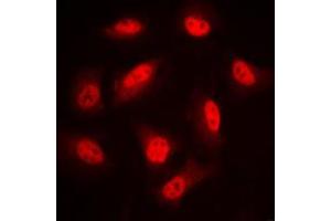 Immunofluorescent analysis of LIMK1/2 (pT508/505) staining in PC12 cells. (LIMK-1/2 (C-Term), (pSer505), (pSer508) anticorps)
