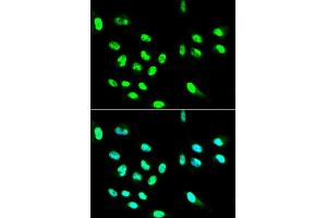 Immunofluorescence analysis of HepG2 cells using FCGR2A antibody (ABIN5970646). (FCGR2A anticorps)