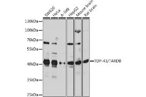 Western blot analysis of extracts of various cell lines, using TDP-43/TARDB antibody  at 1:1000 dilution. (TARDBP anticorps  (AA 1-100))