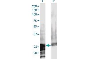 Western Blot analysis of NOL3 expression in transfected 293T cell line by NOL3 monoclonal antibody (M02), clone 3A9. (NOL3 anticorps  (AA 1-208))