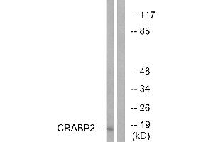 Western blot analysis of extracts from HT-29 cells, using CRABP2 antibody. (CRABP2 anticorps)