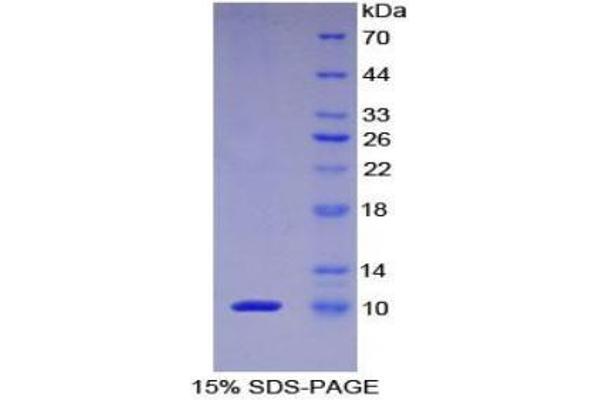 PKIA Protéine