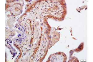 Formalin-fixed and paraffin embedded human placenta labeled with Anti-TRIM29 Polyclonal Antibody, Unconjugated (ABIN873066) at 1:200 followed by conjugation to the secondary antibody and DAB staining (TRIM29 anticorps  (AA 253-283))