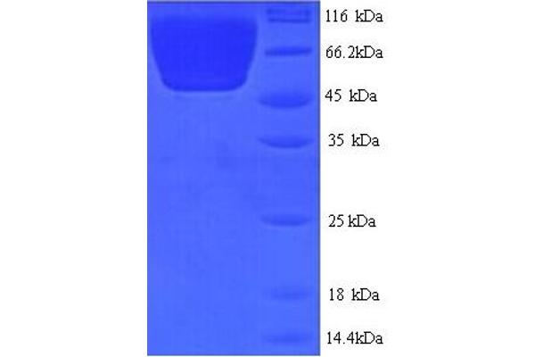 SMG7 Protein (AA 19-550, partial) (His tag)