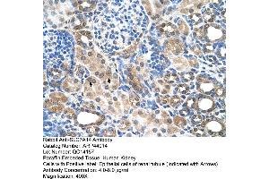 Human kidney (SLC7A14 anticorps  (N-Term))