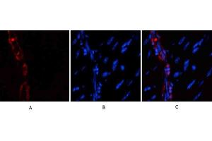 Immunofluorescence analysis of mouse heart tissue. (alpha-SMA (AA 171-220) anticorps)