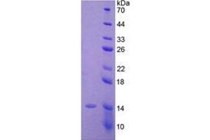 Image no. 1 for Anti-Mullerian Hormone (AMH) (AA 453-560) (Active) protein (His tag) (ABIN5665761) (AMH Protein (AA 453-560) (His tag))