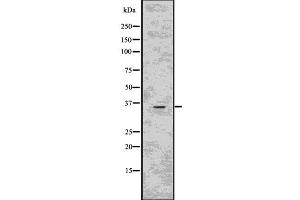 Western blot analysis of CD40LG using HepG2 whole  lysates. (CD40 Ligand anticorps  (Internal Region))