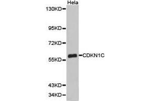 Western Blotting (WB) image for anti-Cyclin-Dependent Kinase Inhibitor 1C (p57, Kip2) (CDKN1C) antibody (ABIN1871758) (CDKN1C anticorps)