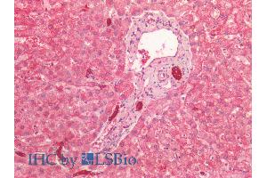 ABIN1781975 (2. (Cytokeratin 19 anticorps  (AA 285-298))