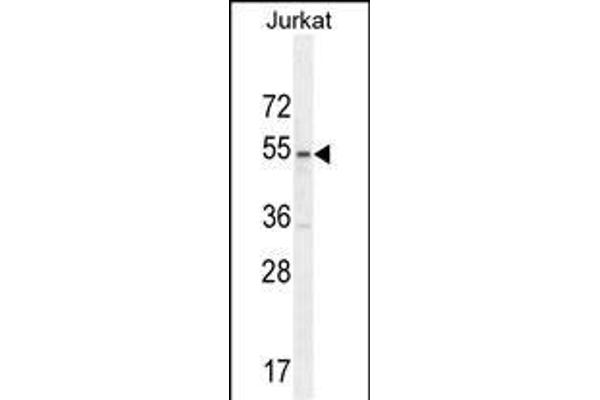 MPP1 anticorps  (AA 301-327)