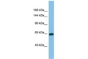 Host:  Rabbit  Target Name:  TPO  Sample Type:  Jurkat Whole Cell lysates  Antibody Dilution:  1. (Thyroperoxidase anticorps  (N-Term))