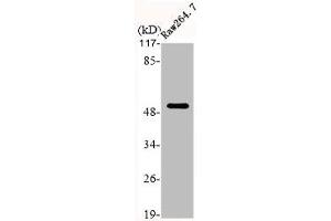 Western Blot analysis of RAE264. (Cytokeratin 7 anticorps  (C-Term))