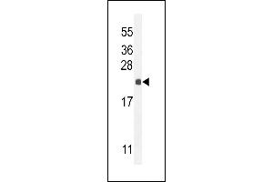 hCG_2024410 Antibody (C-term) (ABIN654993 and ABIN2850479) western blot analysis in mouse liver tissue lysates (35 μg/lane). (hCG_2024410 (AA 187-215), (C-Term) anticorps)