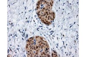 Immunohistochemical staining of paraffin-embedded Kidney tissue using anti-IFT57 mouse monoclonal antibody. (IFT57 anticorps)