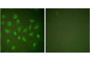 Immunofluorescence analysis of HeLa cells, treated with PMA (125ng/ml, 30mins), using POLR2A (epitope around residue 1619) antibody (ABIN5976162). (POLR2A/RPB1 anticorps  (Ser1619))