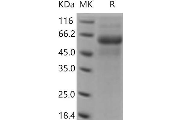 DDR2 Protein (His tag)