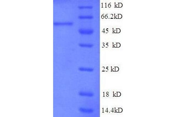 TRAP1 Protein (AA 60-308, partial) (GST tag)