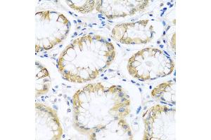 Immunohistochemistry of paraffin-embedded human stomach using PCDHA12 antibody. (PCDHA12 anticorps)