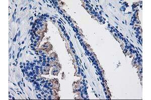 Immunohistochemistry (IHC) image for anti-TBC1 Domain Family, Member 21 (TBC1D21) antibody (ABIN1501312) (TBC1D21 anticorps)