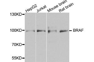 Western blot analysis of extracts of various cell lines, using BRAF antibody (ABIN5974879) at 1/1000 dilution. (BRAF anticorps)