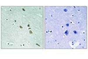 Immunohistochemistry analysis of paraffin-embedded human brain tissue using ILK (Ab-246) antibody. (ILK anticorps  (Ser246))