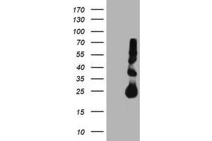 HEK293T cells were transfected with the pCMV6-ENTRY control (Left lane) or pCMV6-ENTRY TIMP2 (Right lane) cDNA for 48 hrs and lysed. (TIMP2 anticorps)