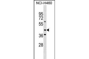 MEIS3 Antibody (Center) (ABIN1538161 and ABIN2849594) western blot analysis in NCI- cell line lysates (35 μg/lane). (MEIS3 anticorps  (AA 240-266))