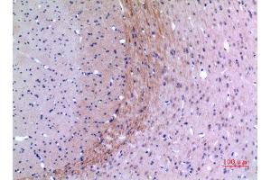 Immunohistochemistry (IHC) analysis of paraffin-embedded Rat Brain, antibody was diluted at 1:100. (LYN anticorps  (Ser780))