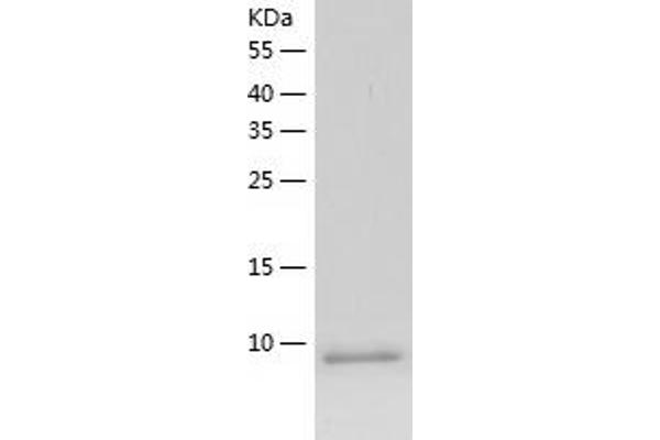 CCL3 Protein (AA 24-92) (His tag)