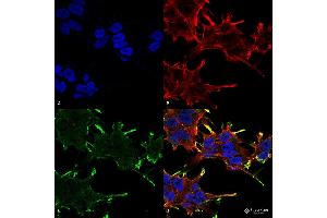 Immunocytochemistry/Immunofluorescence analysis using Mouse Anti-Alpha B Crystallin Monoclonal Antibody, Clone 1A7. (CRYAB anticorps  (PerCP))