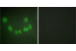 Immunofluorescence analysis of HuvEc cells, using CDC2 Antibody. (CDK1 anticorps  (AA 101-150))