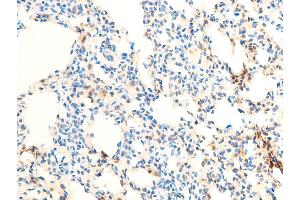 Immunohistochemistry (IHC) image for anti-Nuclear Factor-kB p65 (NFkBP65) (pSer536) antibody (ABIN6255402)