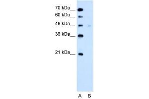 WB Suggested Anti-SLC43A3  Antibody Titration: 2. (SLC43A3 anticorps  (N-Term))
