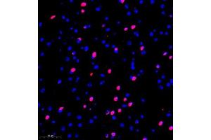 Immunofluorescence of paraffin embedded mouse brain using kb12 (ABIN7075406) at dilution of 1:700 (300x lens) (p130 anticorps)