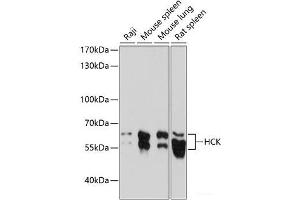 Western blot analysis of extracts of various cell lines using HCK Polyclonal Antibody at dilution of 1:1000. (HCK anticorps)