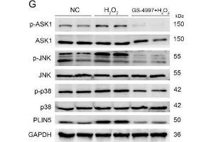 The expression of PLIN5 was regulated by the JNK-p38-ATF pathway. (MAPK14 anticorps  (C-Term))