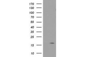 Image no. 1 for anti-Baculoviral IAP Repeat-Containing 5 (BIRC5) antibody (ABIN1501247) (Survivin anticorps)