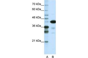 Western Blotting (WB) image for anti-TAR DNA Binding Protein (TARDBP) antibody (ABIN2461819) (TARDBP anticorps)
