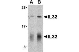 Western blot analysis of IL-32 in human spleen cell lysate with AP30424PU-N IL-32 antibody at (A) 5 and (B) 10 μg/ml shows two isoforms of IL-32. (IL32 anticorps  (C-Term))