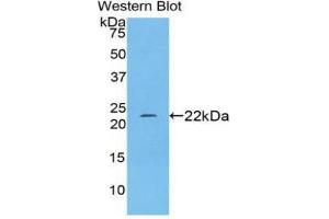 Western Blotting (WB) image for Nitric Oxide Synthase 2, Inducible (NOS2) ELISA Kit (ABIN6574225)